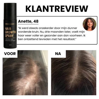 Hair Growth Spray Formule